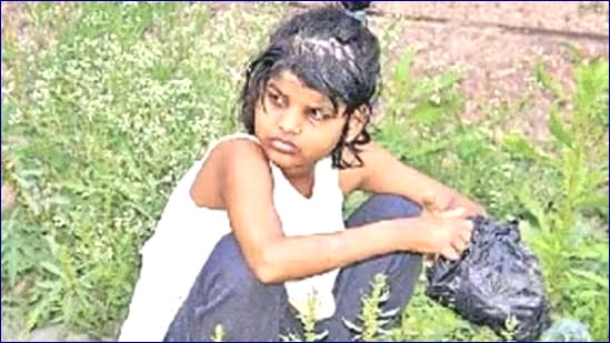 Mowgli Girl: Forest Foundling Passes Away at 18 After Years of Healing in Lucknow