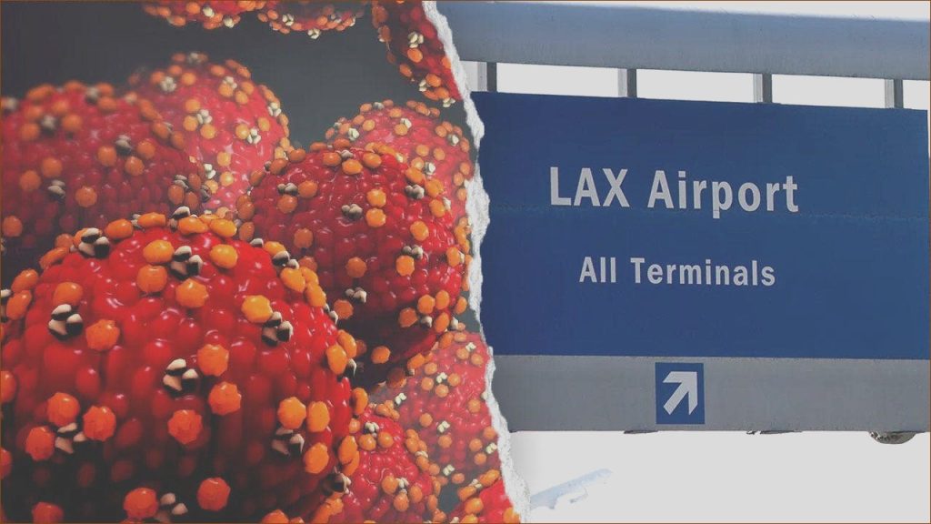 Measles Alert Issued for LAX and Nearby Hilton Following June Flight Exposure