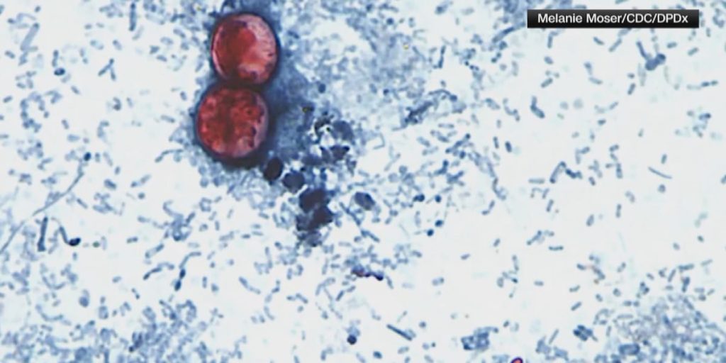 State Probes Oahu’s First Suspected Local Cyclospora Case